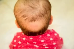 علل و راه‌های مقابله با ریزش مو در نوزادان و کودکان