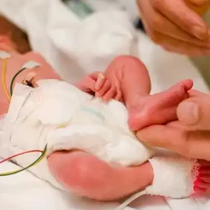 چطور از نوزاد نارس مراقبت کنیم؟