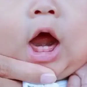 علائم دندان درآوردن نوزاد